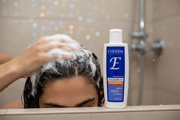 کاربرد شامپو سیکلوزینک دی اویدرم برای کاهش شوره سر