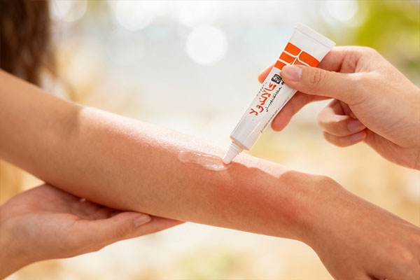 پماد کالاندولا دینه برای تسکین آفتاب سوختگی