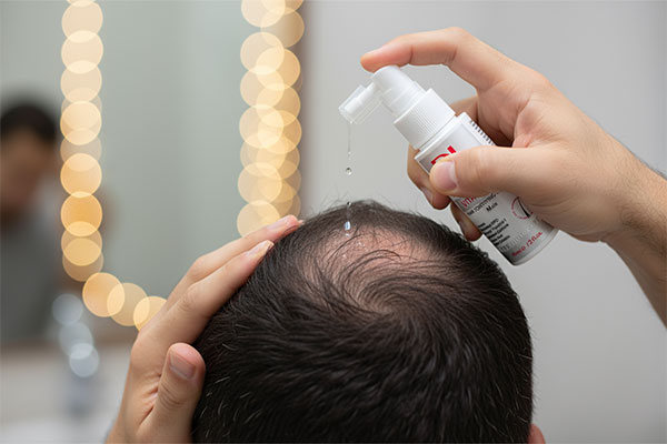 استفاده از لوسیون تقویت کننده موی آقایان ویتا گرو درمالیفت روی پوست سر