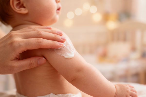 دست والدین در حال استفاده از لوسیون بدن کودک پرودرما روی پوست نوزاد