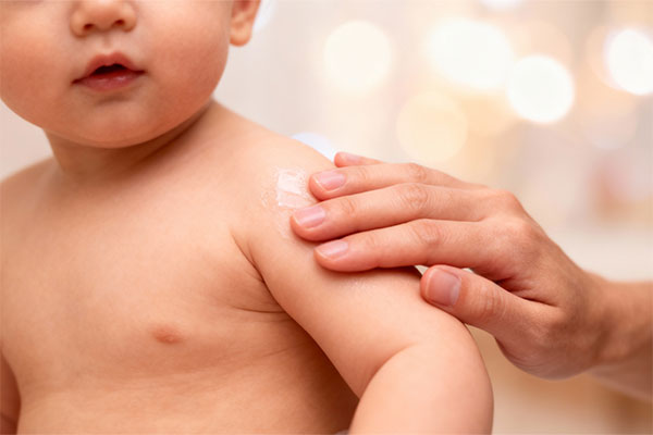 آبرسانی پوست کودک با لوسیون مرطوب کننده بدن بیبی اسکین